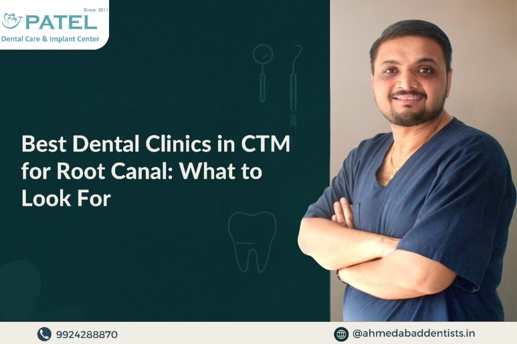 Best Root Canal Treatment in CTM, Ahmedabad