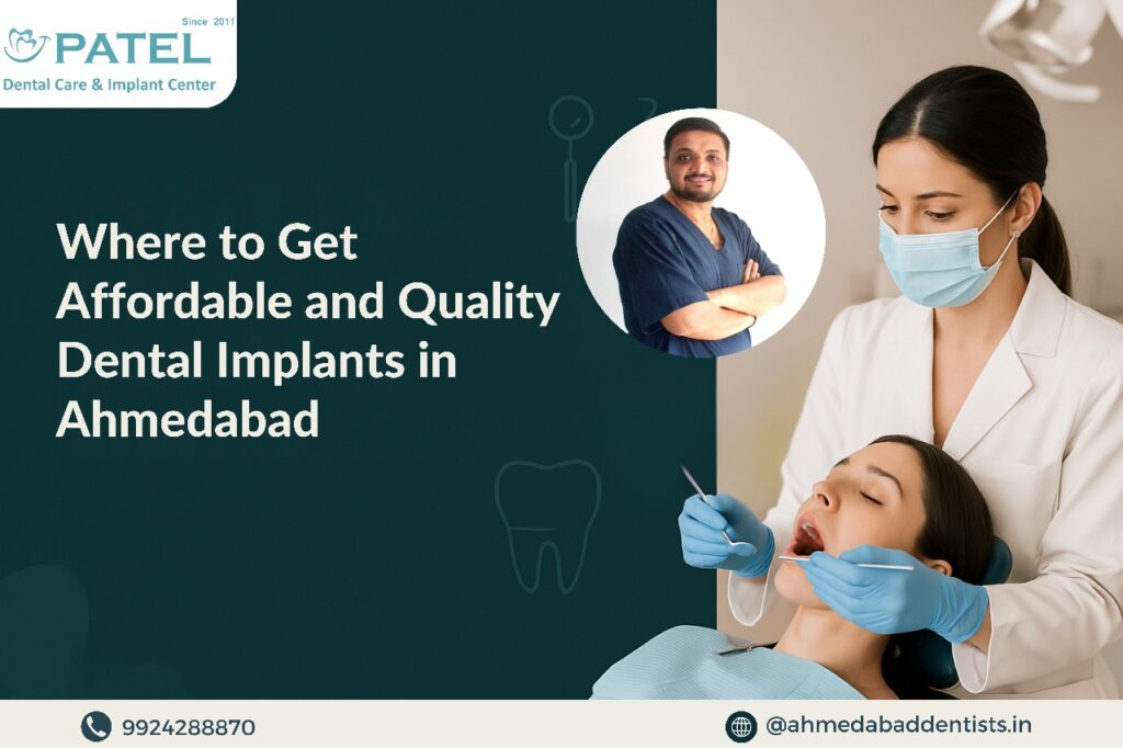 Dental implants in Ahmedabad