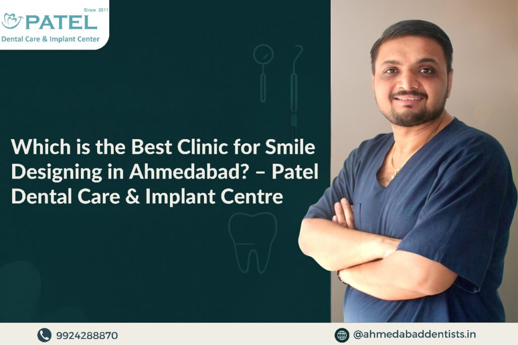 smile designing in ahmedabad