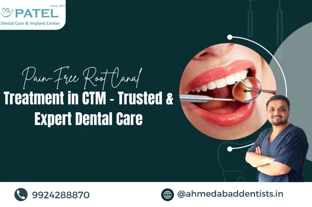 Root Canal Treatment in CTM