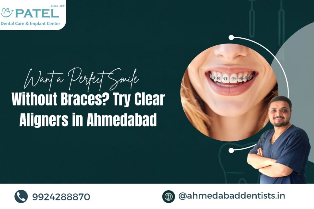 Clear Aligners in Ahmedabad