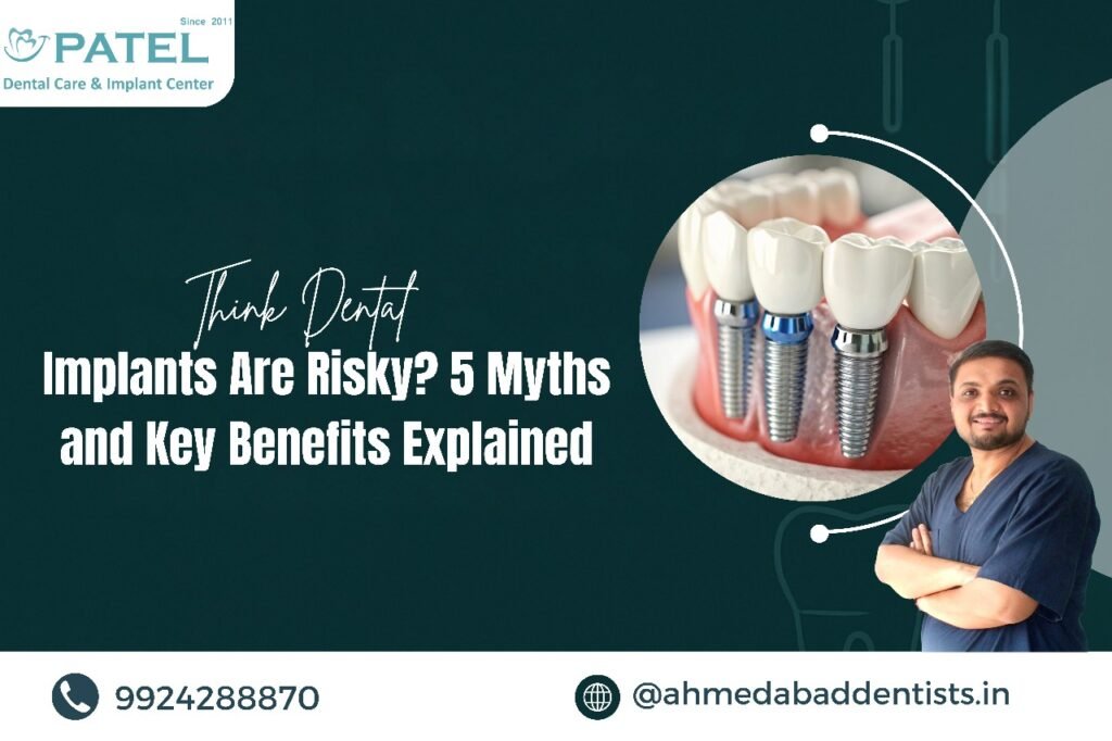 Best Dental Implants in Ahmedabad: