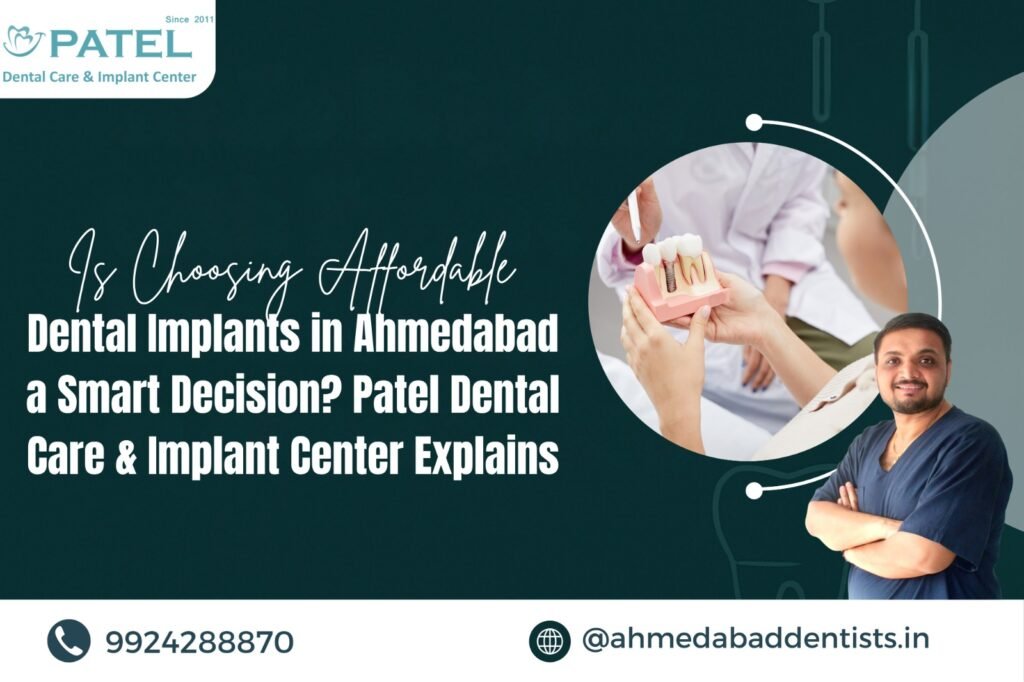 Affordable Dental Implant in Ahmedabad