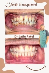 smile designing in ahmedabad