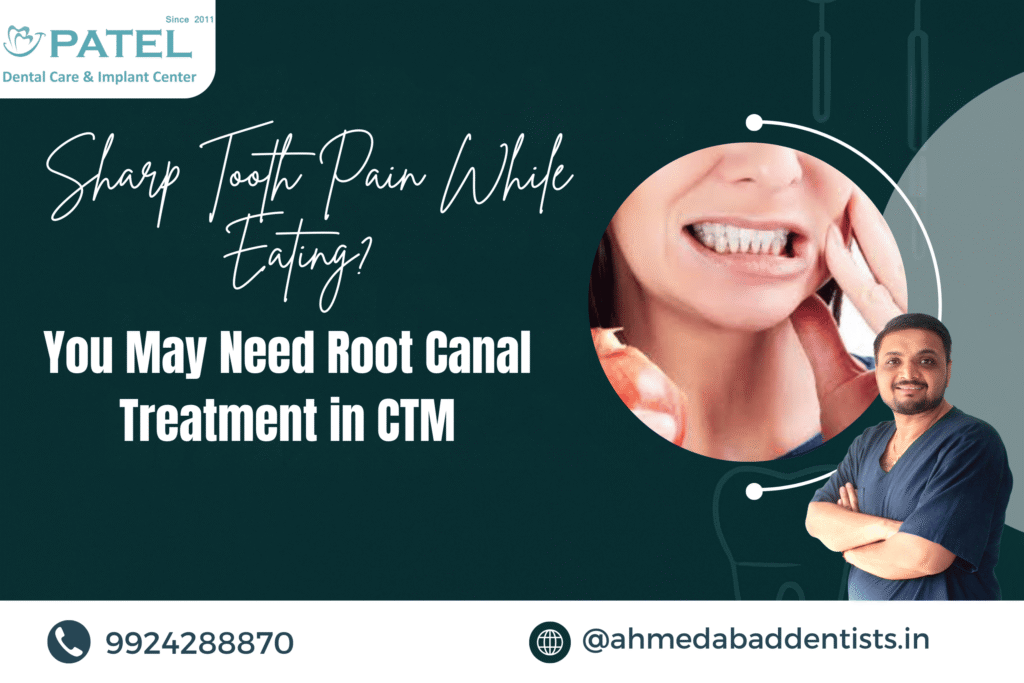 Root Canal Treatment in CTM