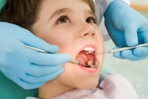 Kids Dentistry in Ahmedabad