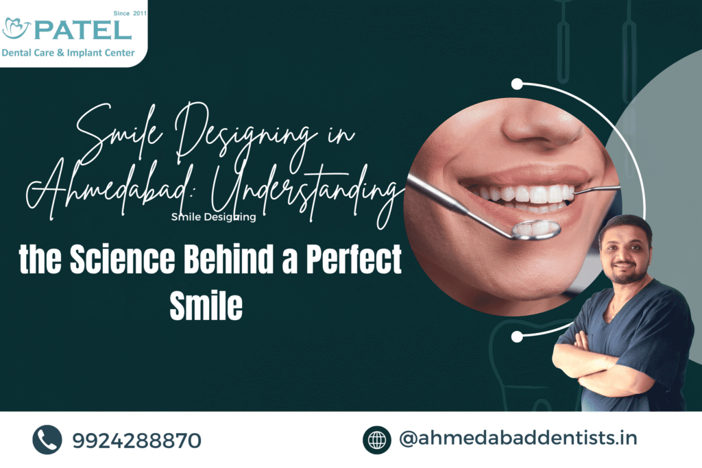 Smile Designing in Ahmedabad