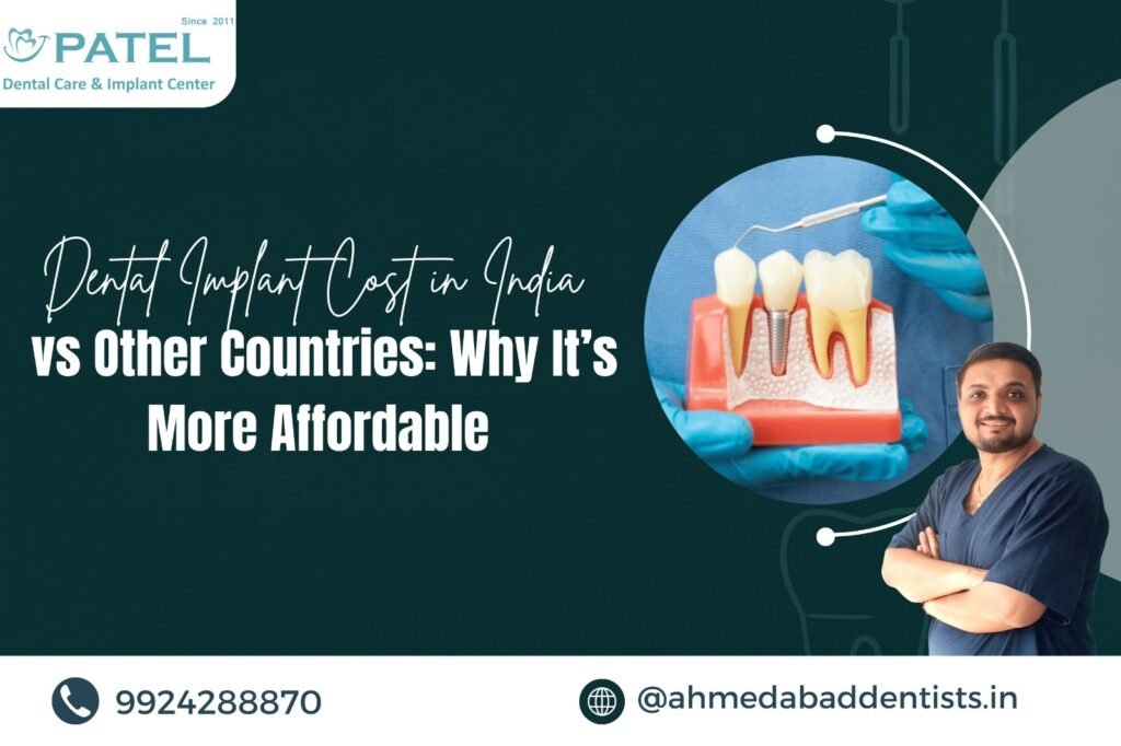 Dental Implant Cost in India