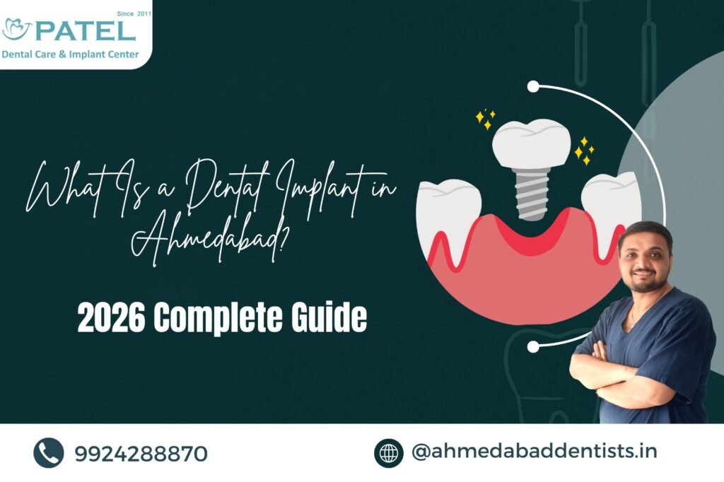 dental implant cost in ahmedabad
